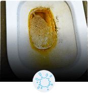 Stains